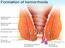 Expertise in anorectal surgeries including fistula in ANO and haemorrhoids (Piles)